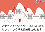 ֥饱åȤ磻䡼ʤɤ֤ȤäƤäưޤ